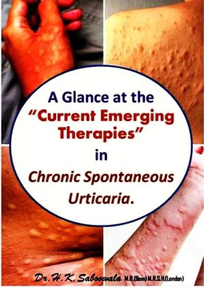 A Glance at the “Current Emerging Therapies” in Chronic Spontaneous Urticaria.