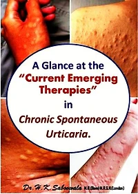 A Glance at the “Current Emerging Therapies” in Chronic Spontaneous Urticaria.