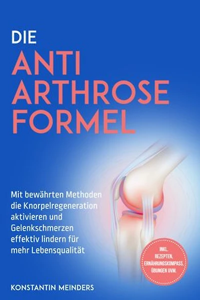 Die Anti Arthrose Formel: Mit bewährten Methoden die Knorpelregeneration aktivieren und Gelenkschmerzen effektiv lindern für mehr Lebensqualität - inkl. Rezepten, Ernährungskompass, Übungen uvm.