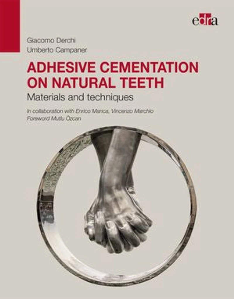 Adhesive Cementation on Natural Teeth. Materials and Techniques