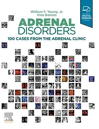 Adrenal Disorders: 100 Cases From The Clinic