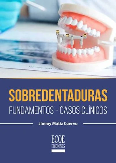 Sobredentaduras: Fundamentos, casos clínicos