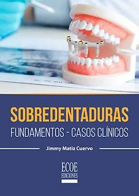 Sobredentaduras: Fundamentos, casos clínicos