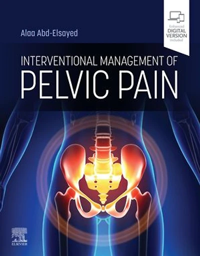 Interventional Management of Pelvic Pain