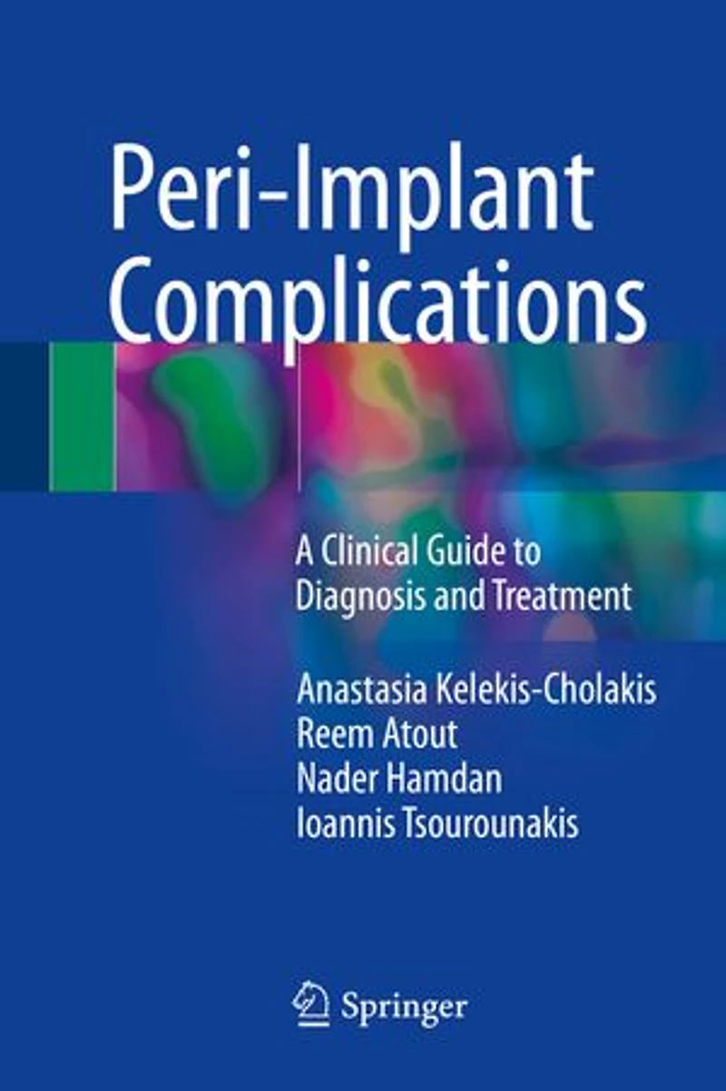 Peri-implant Complications: A Clinical Guide To Diagnosis And Treatment