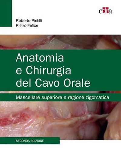Anatomia e Chirurgia del Cavo Orale: Mascellare superiore e Regione zigomatica