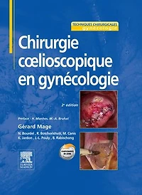 Chirurgie cœlioscopique en gynécologie