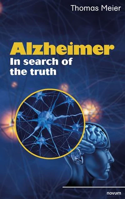 Alzheimer - search of the truth