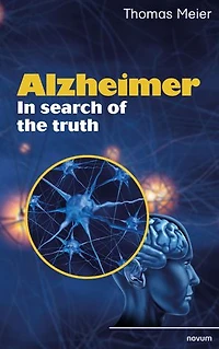 Alzheimer - search of the truth