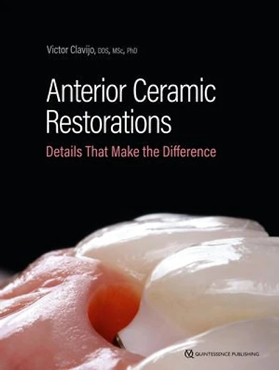 Anterior Ceramic Restorations: Details That Make the Difference