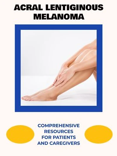 Acral Lentiginous Melanoma: Comprehensive Resources for Patients and Caregivers