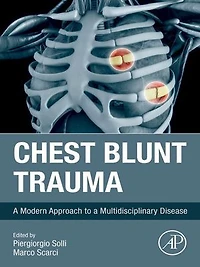 Chest Blunt Trauma: a Modern Approach to Multidisciplinary Disease