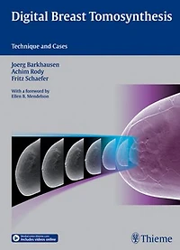 Digital Breast Tomosynthesis: Technique And Cases