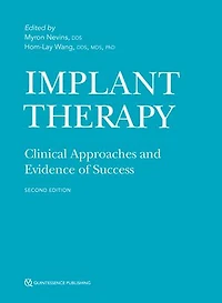 Implant Therapy: Clinical Approaches And Evidence Of Success