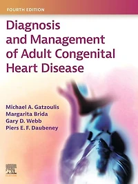 Diagnosis and Management of Adult Congenital Heart Disease