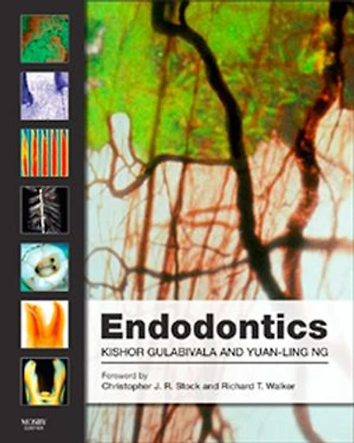 Endodontics E-Book: Endodontics E-Book
