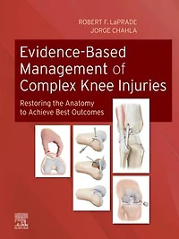 Evidence-Based Management of Complex Knee Injuries E-Book: Restoring the Anatomy to Achieve Best Outcomes