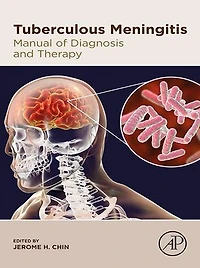 Tuberculous Meningitis: Manual Of Diagnosis And Therapy