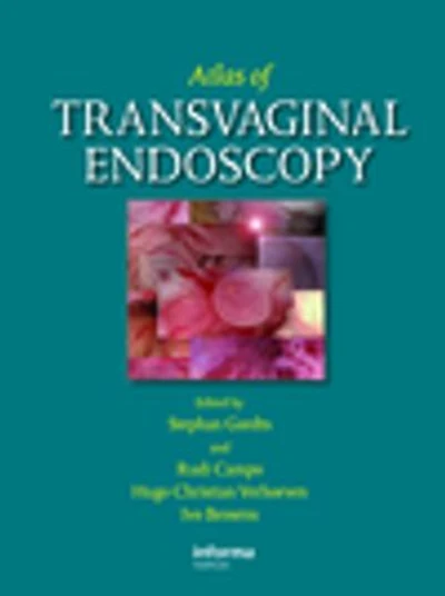 Atlas of Transvaginal Endoscopy