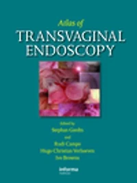 Atlas of Transvaginal Endoscopy