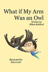 What if my Arm was an Owl?
