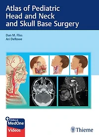 Atlas Of Pediatric Head And Neck Skull Base Surgery