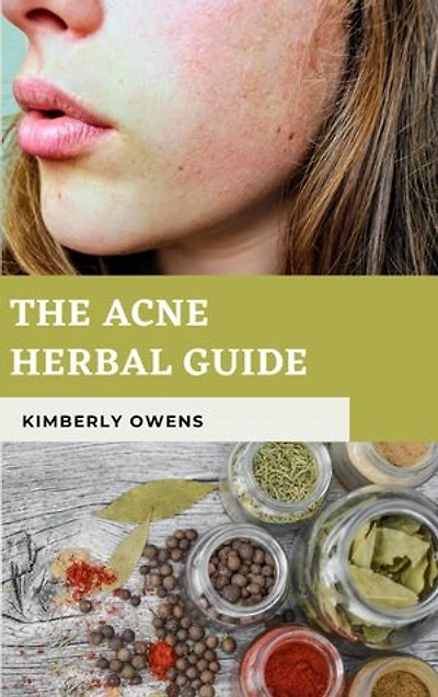 THE ACNE HERBAL GUIDE: How to Naturally Control Hormones, Reduce Sebum, and Treat Acne and Other Common Skin Conditions