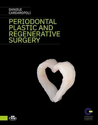 Peridontal plastic and regenerative surgery