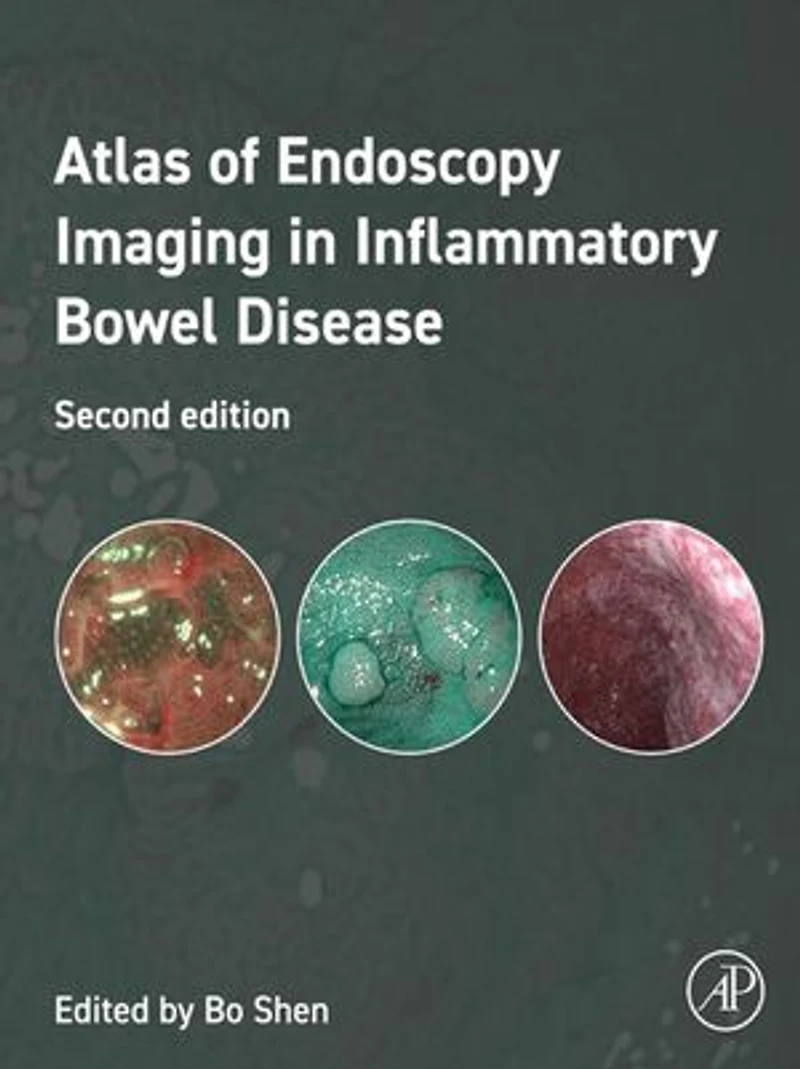 Atlas of Endoscopy Imaging Inflammatory Bowel Disease