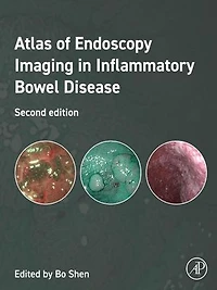 Atlas of Endoscopy Imaging Inflammatory Bowel Disease
