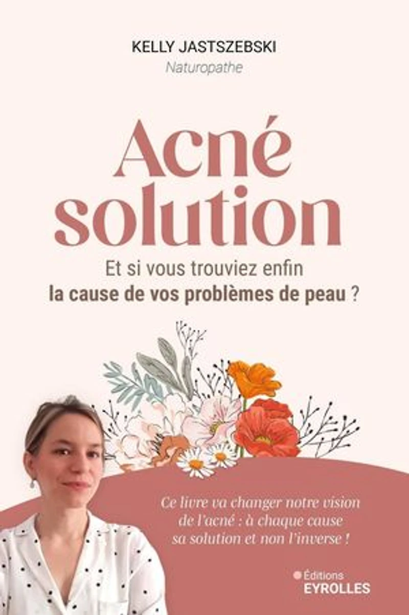 Acné solution: et si vous trouviez enfin la cause de vos problèmes peau ?