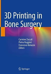 3D Printing Bone Surgery