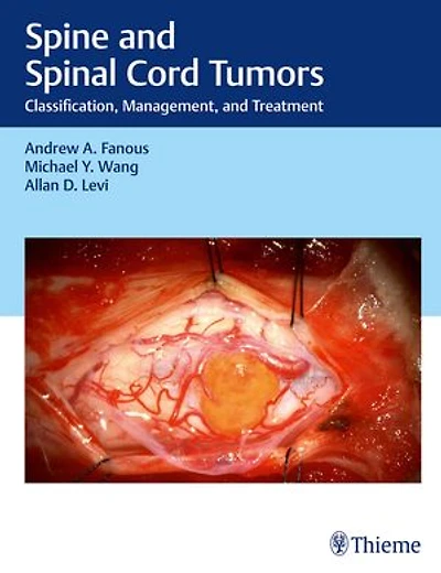 Spine and Spinal Cord Tumors: Classification, Management, and Treatment