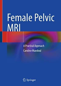 Female Pelvic MRI: A Practical Approach