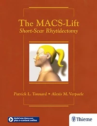 The Macs-lift: Short-scar Rhytidectomy
