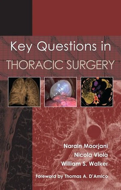 Key Questions Thoracic Surgery
