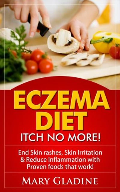 Eczema Diet: Itch No More! End Skin rashes, skin irritation & reduce inflammation with A Low Inflammation Diet & Proven foods that work! BONUS know what to avoid!