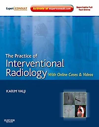 The Practice of Interventional Radiology, with Online cases and video: Expert Consult Premium Edition - Enhanced Features Print, 1e