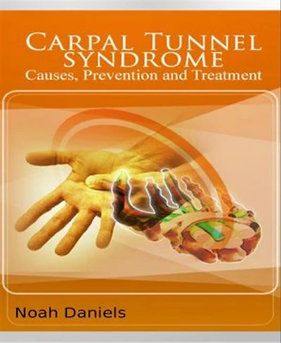 Carpal Tunnel Syndrome - Causes, Prevention and Treatment