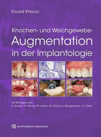 Knochen- und Weichgewebeaugmentation in der Implantologie