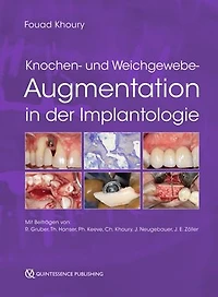 Knochen- und Weichgewebeaugmentation in der Implantologie