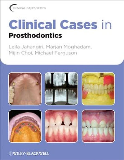 Clinical Cases Prosthodontics
