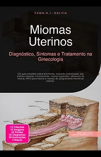 Miomas Uterinos: Diagnóstico, Sintomas e Tratamento na Ginecologia