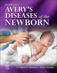 Avery's Diseases of the Newborn