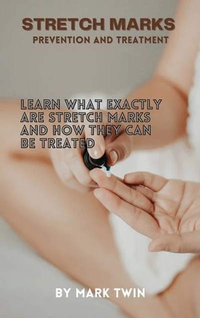 STRETCH MARKS PREVENTION AND TREATMENT