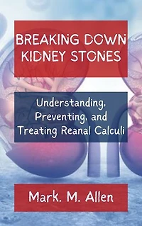 BREAKING DOWN KIDNEY STONES: Understanding, Preventing, and Treating Renal Calculi