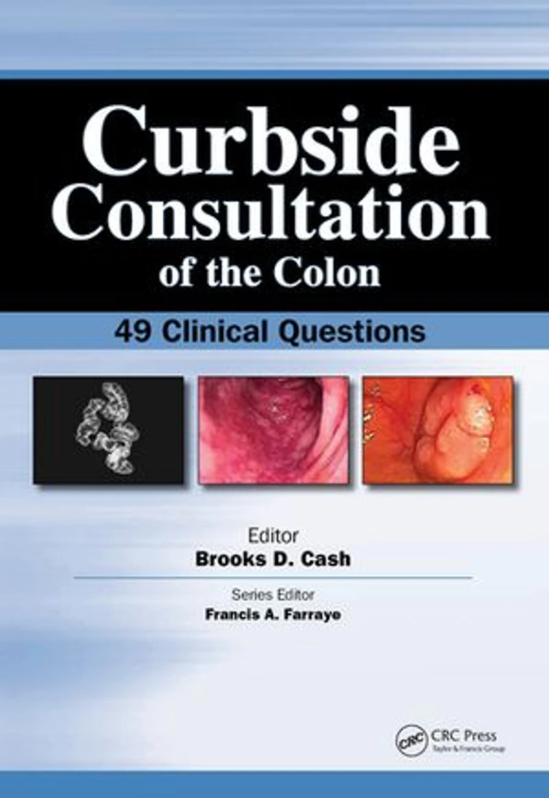 Curbside Consultation of the Colon: 49 Clinical Questions