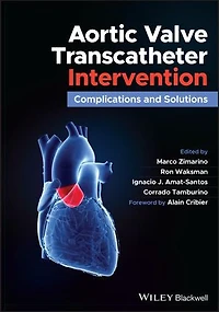 Aortic Valve Transcatheter Intervention: Complications And Solutions