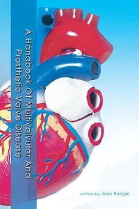 A Handbook Of Multivalvular And Prosthetic Valve Disease