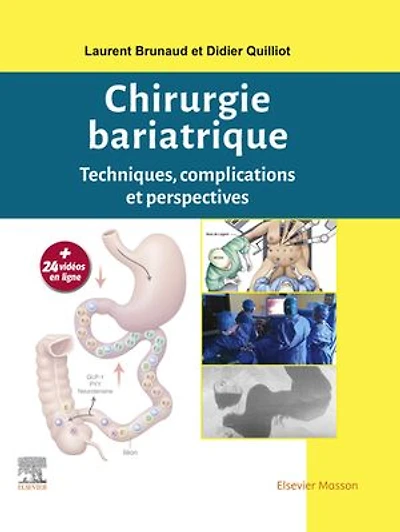 Chirurgie bariatrique: Techniques, complications et perspectives